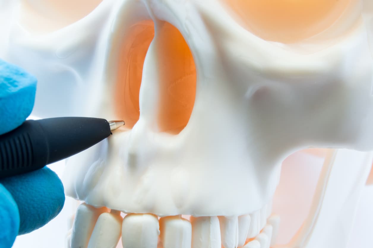 Doctor showing patient bone anatomy of skeleton of nose and nasal cavity on skull. Preparing for rhinoplasty surgery, correcting deviated nasal septum, localization of rhinitis, sinusitis in nose stock photo